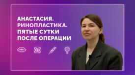 Анастасия. Ринопластика. 5 сутки после операции