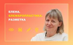 Елена. Блефаропластика. Разметка