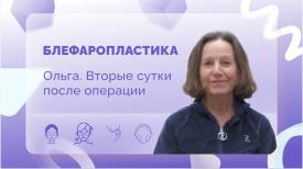 Ольга. Блефаропластика. Вторые сутки после операции.
