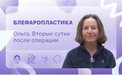 Ольга. Блефаропластика. Вторые сутки после операции.