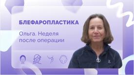Ольга. Блефаропластика. Неделя после операции