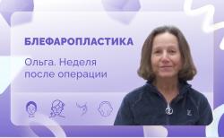 Ольга. Блефаропластика. Неделя после операции