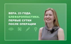 Вера. 23 года. Блефаропластика. Первые сутки после операции