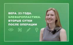 Вера. 23 года. Блефаропластика. Вторые сутки после операции