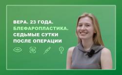Вера. 23 года. Блефаропластика. Седьмые сутки после операции