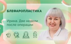 Ирина. 14 сутки после операции